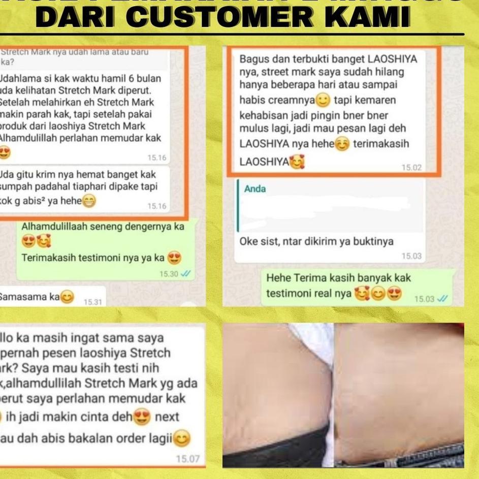 Berkualitas PENGHILANG STRETCH MARK PALING AMPUH LAOSHIYA STRETCH MARKS CREAM ORIGINAL BPOM ..