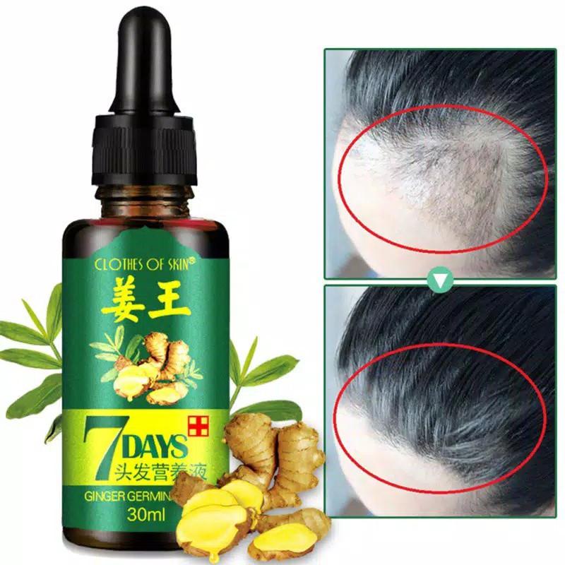 [ PENUMBUH RAMBUT BOTAK ] Essence Anti Rontok / Botak Asli Obat Uban Penghitam Penyubur Original