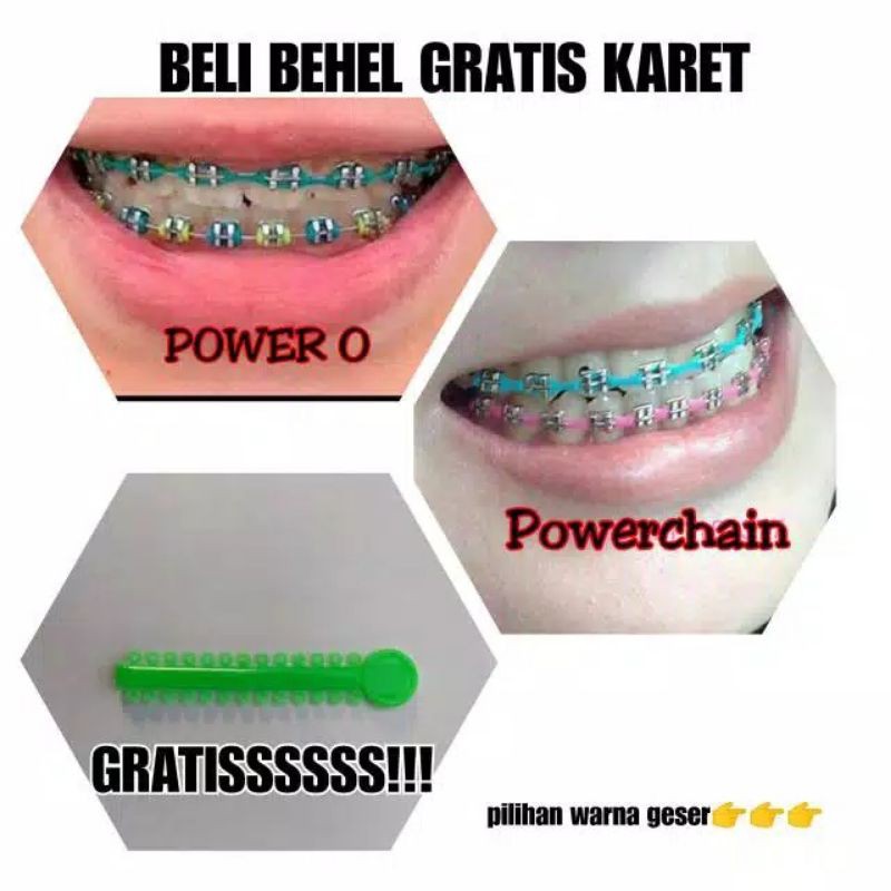 Behel fashion terbaru murah bonus karet