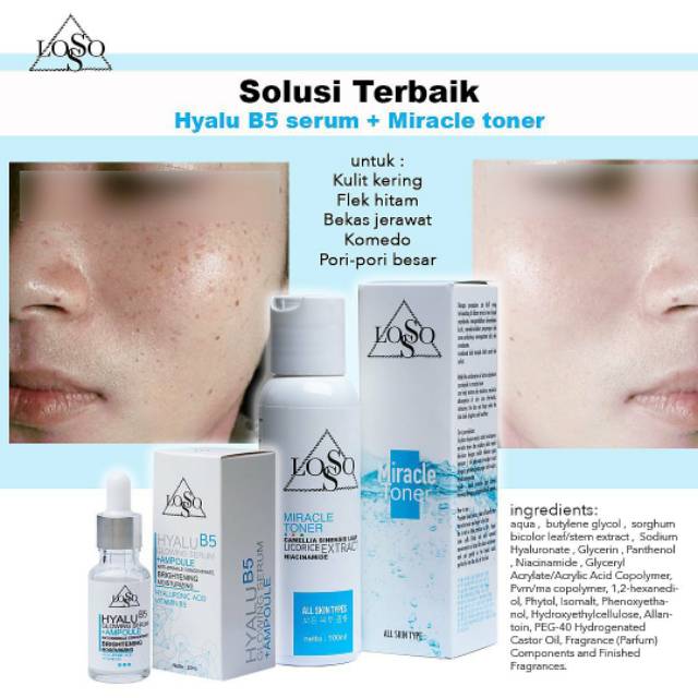 Hyalu B5 Gowing serum + BMW