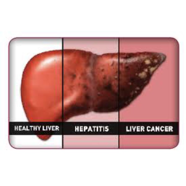 

Hepatosol Lola