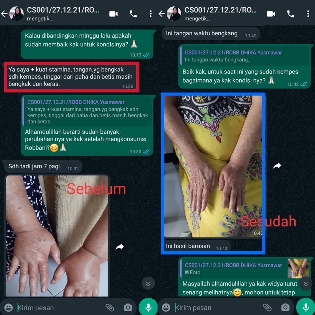 Robbani obat asam urat darah tinggi hipertensi nyeri sendi diabetes kencing manis penurun gula darah kolesterol habbatussauda oil extra propolis sm asli original herbal bpom ampuh