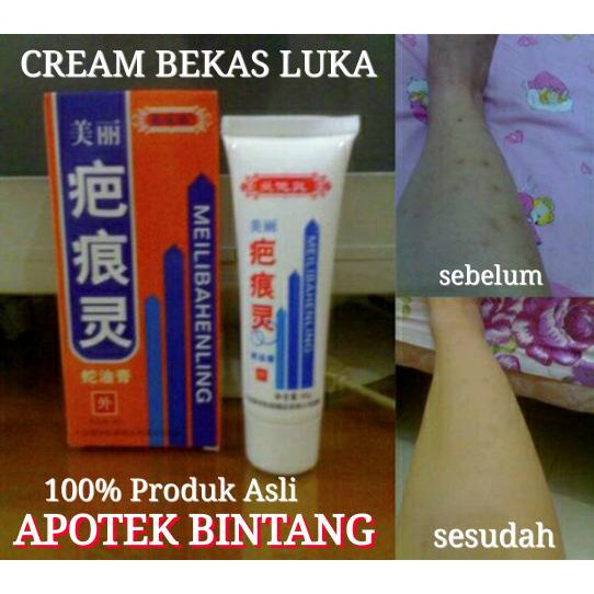 Cream Penghilang Bekas Luka Obat Bekas Luka Lama Bekas Luka Baru Cream Pemutih Kulit Tubuh Shopee Indonesia