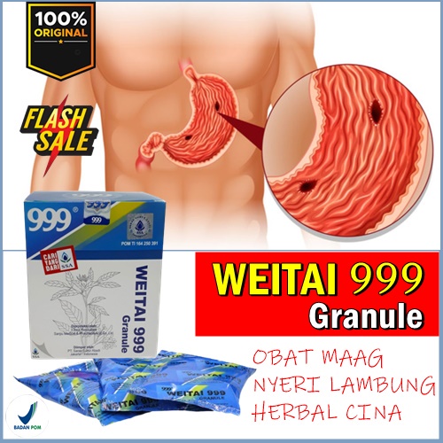 TERLARIS weitai 999 granule obat maag obat tradisional cina sakit lambung alami terbaik ampuh origin