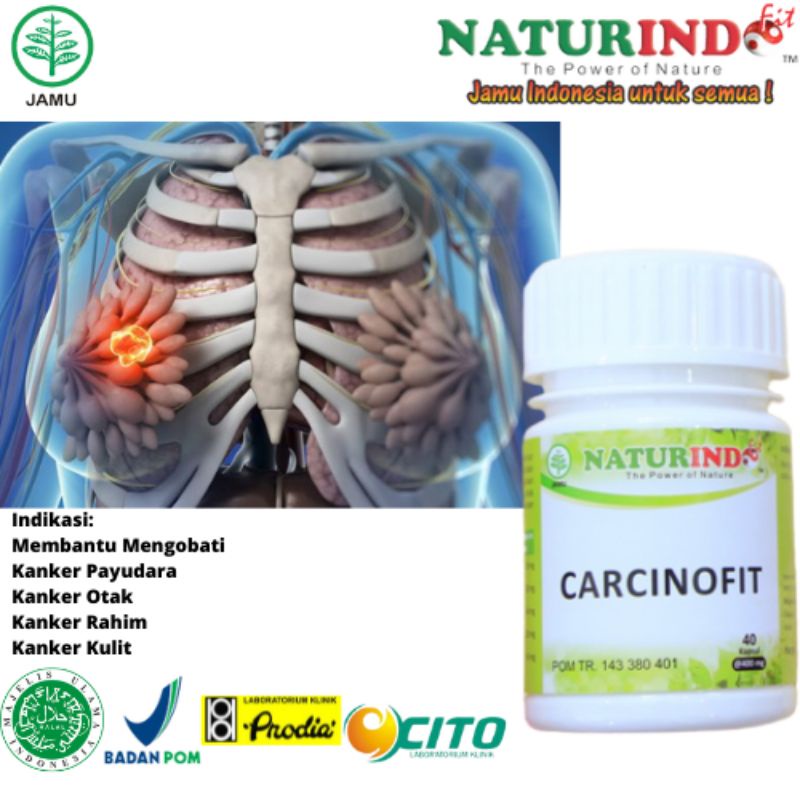 

Obat Ampuh Obati Kanker Tanpa Operasi