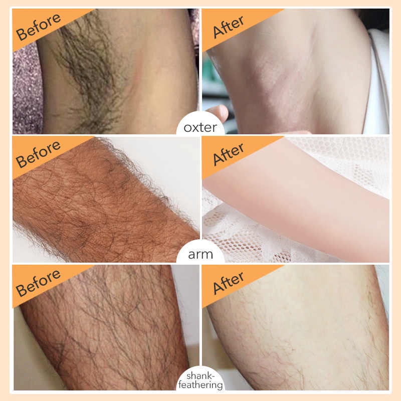 150ml hair removal spray penghilang bulu ketiak hair removal penghilang bulu baju  hair removal bagian pribadi penghilangan rambut tanpa rasa,menghambat pertumbuhan rambut