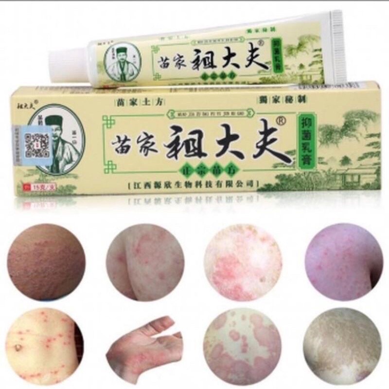COD Salep Zudaifu Obat Untuk Alergi Gatal Jamuran Jerawat Eksim
