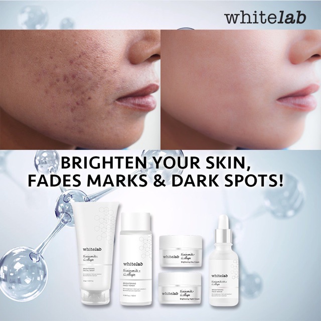 Whitelab Brightening Day Cream - Whitelab Surabaya