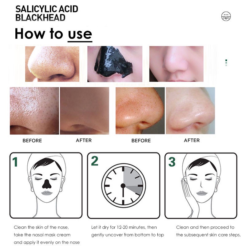 [ BISA COD ] Zoo Son Blackhead Masker Arang Hitam Ampuh Mengangkat Komedo