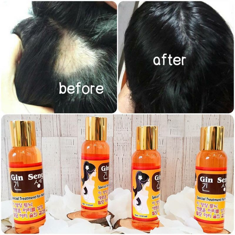 Hair Tonic Red Ginseng Korea Penumbuh Rambut