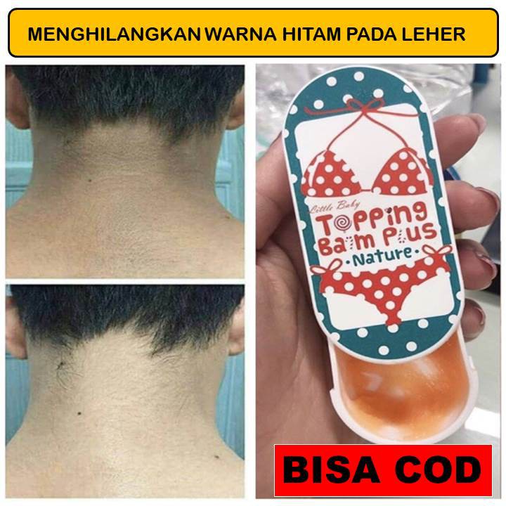 TOPPING TOPING BALM PLUS  CREAM KRIM PEMUTIH PENCERAH MEMUTIHKAN KETIAK DAN SELANGKANGAN STRETCH MAR
