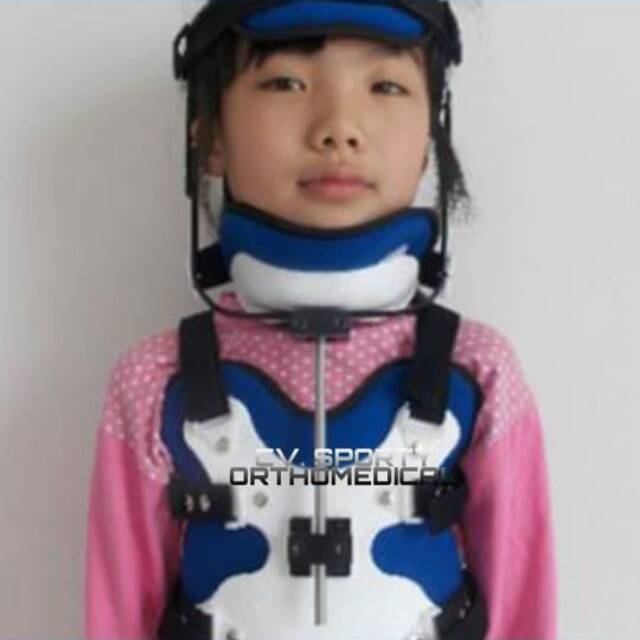 Cervical Thoracal Orthosis /CTO Brace/Penyangga leher anak