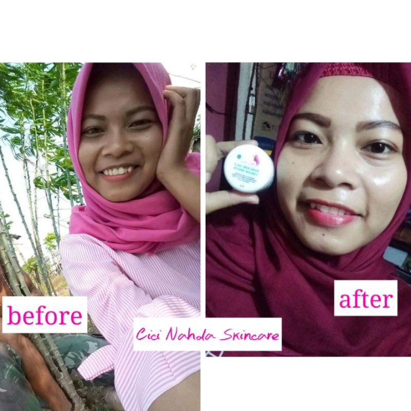 Nahda Skincare Acne glowing 100% orginal