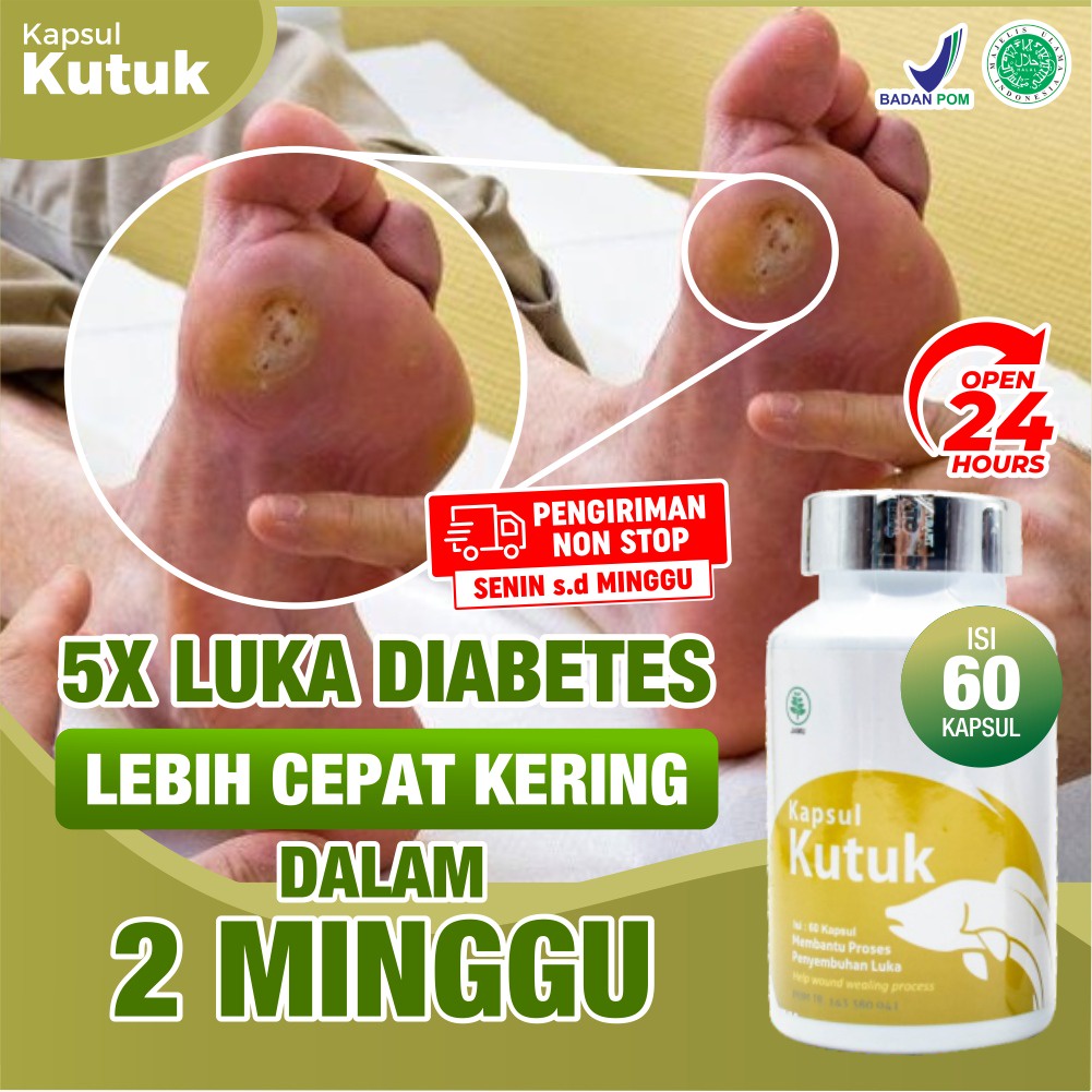 Paket Diabetes 2 Botol Kapsul Kutuk - Kapsul Pengering Luka Diabet Ekstrak Albumin Ikan Gabus Percepat Penyembuhan Luka Pasca Operasi Sesar Caesar Luka Bakar