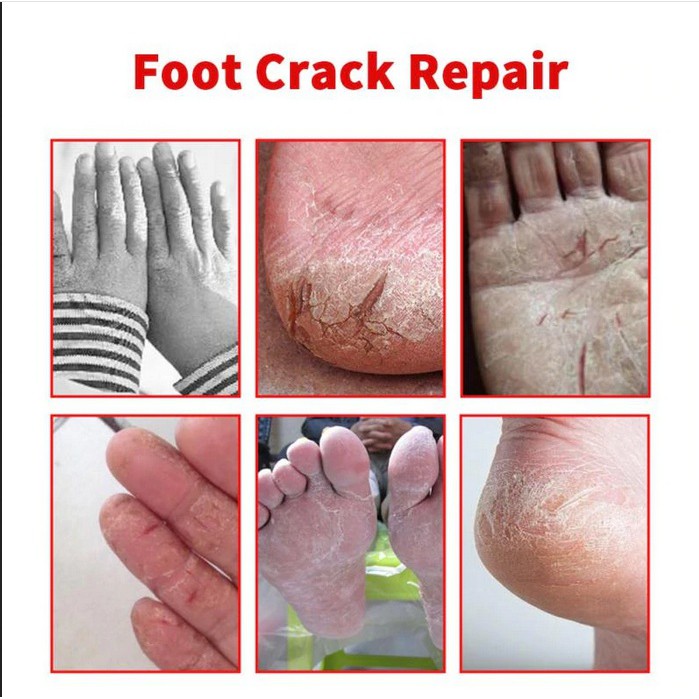 GOOD QUALITY Hand Foot Crack Cream Penghalus Tumit Pecah Pecah