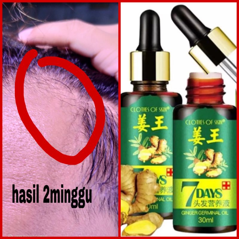 7 DAYS 30 ML(penumbuh rambut ORI di Jamin