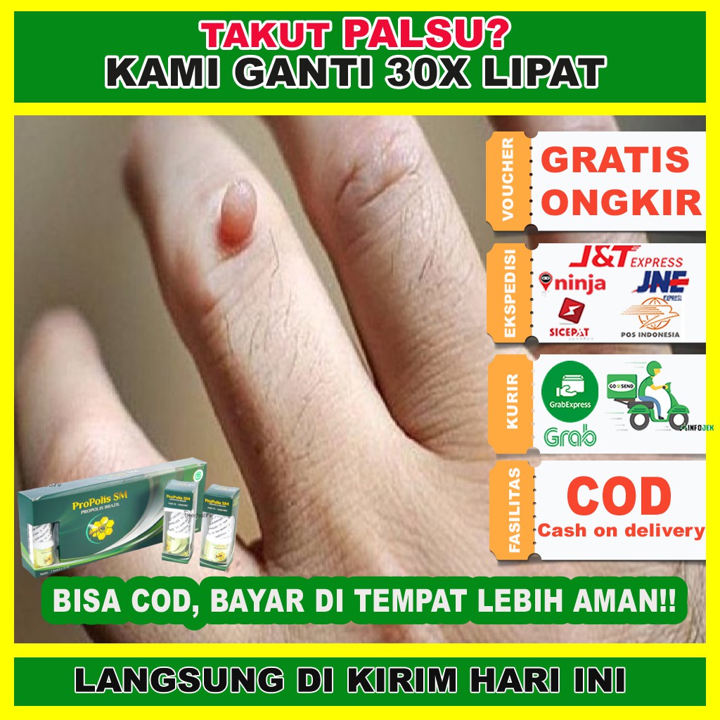 Obat Kutil, Obat Penghilang Kutil - Propolis Brazil SM Asli Original - Propolis SM