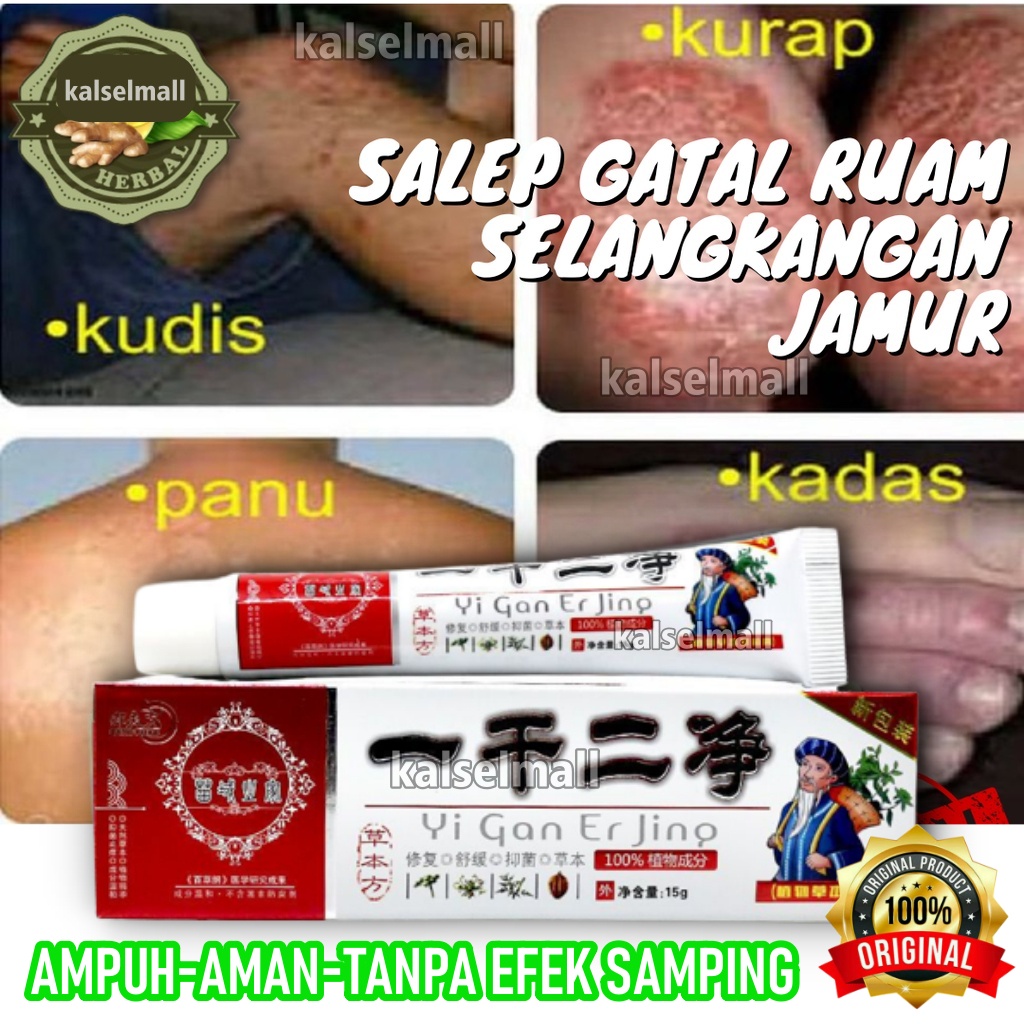 Salep Cream Krim Krem Obat Salap Gatal Yiganerjing ORIGINAL 100% Alergi Jamur Panu Kadas Ruam Eksim Selangkangan Jamuran Jerawat Kudis Korengan Kurap Kutu Air Psoriasis Skabies Panuan Keputihan Cina Herbal Tradisional OC13