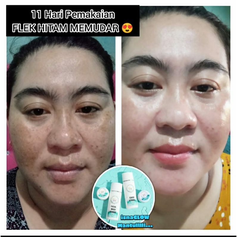 ISNAGLOW SKINCARE AMAN,HALAL DAN SUDAH BPOM