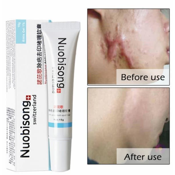 NUOBISONG Cream Wajah Scar Remover Penghilang Bekas Luka Jerawat