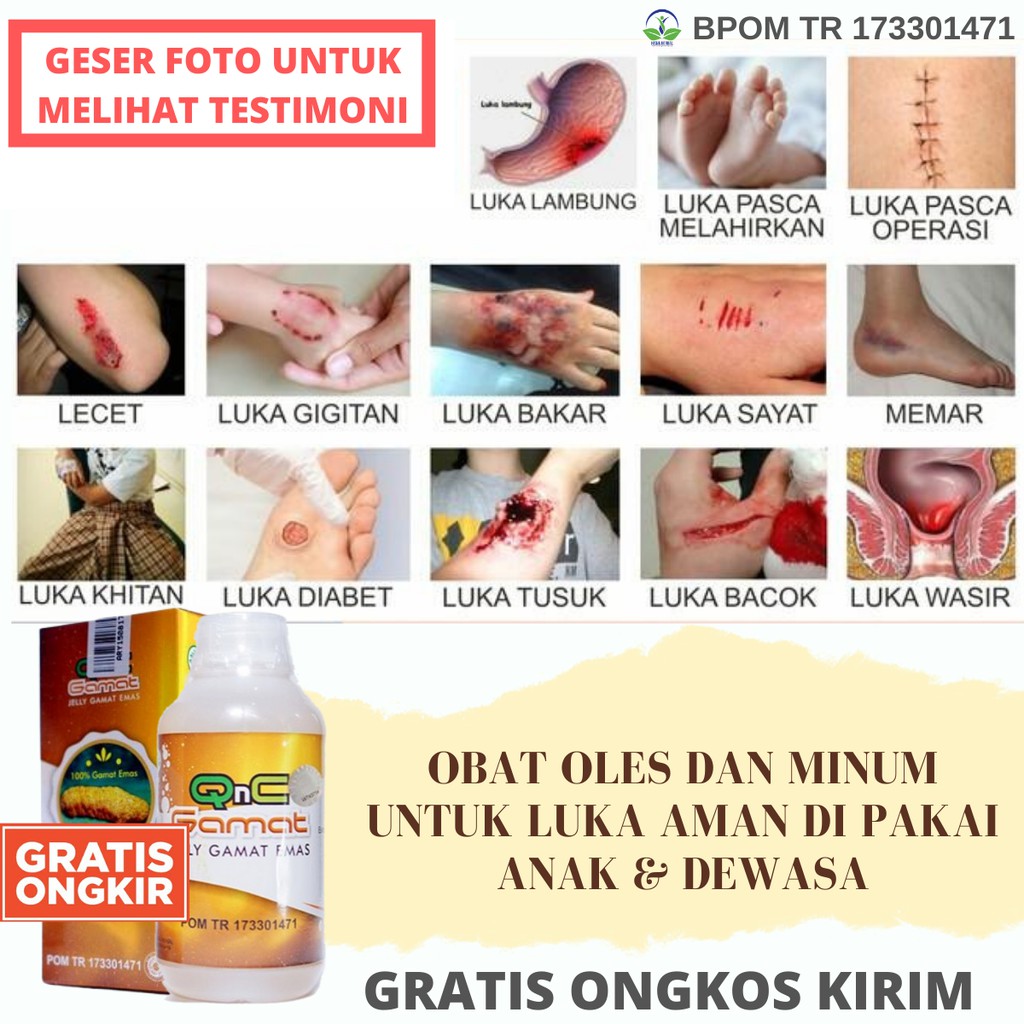 Gratis Ongkir Obat Oles Salep Pengering Luka Kanker Payudara Herbal Kering Sembuh Qnc Jelly Gamat Shopee Indonesia