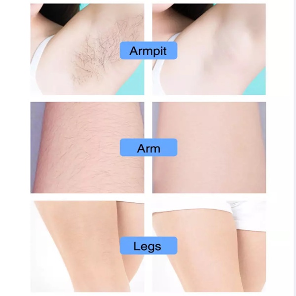 Penghilang Bulu ketiak Spray  Hair Removal   Removal Krim Pemutih Dan Penghilang Rambut Hair Penghilang Bulu Dengan Lembut Tanpa Rasa Sakit Untuk Bagian Pribadi