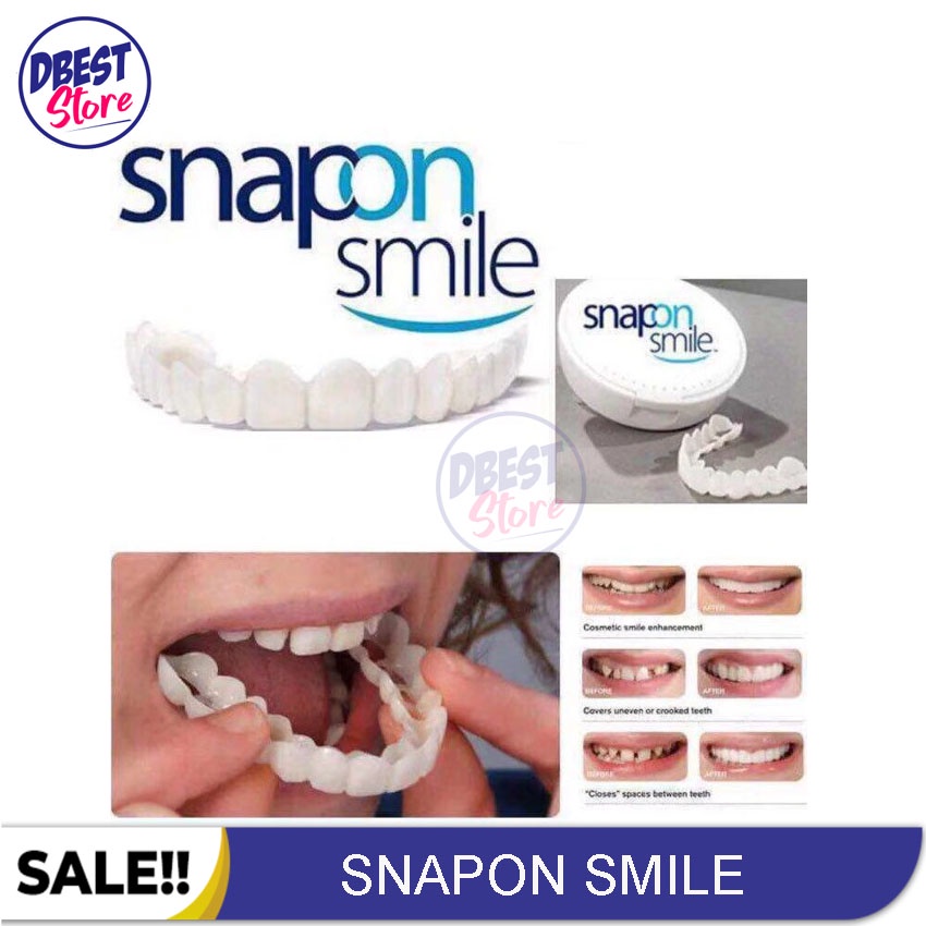 [ COD ] ORIGINAL 100% SNAP ON SMILE AUTHENTIC / GIGI PALSU SEPASANG ATAS BAWAH