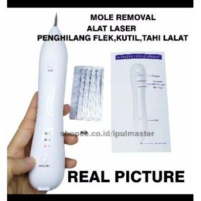 

laser mole removal pen spot eraser