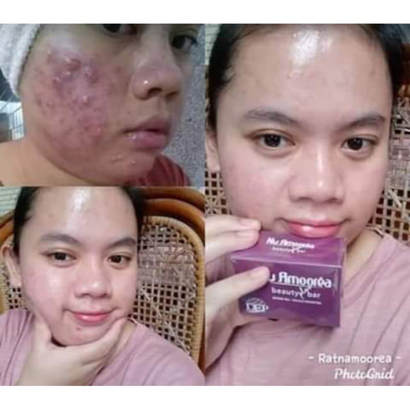 Nu Amoorea Beauty Plus Bar Original