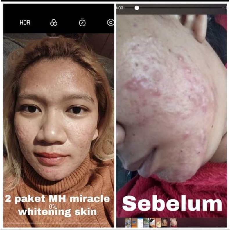 (FREE ONGKIR/COD)PAKET MURAH HEMAT MH MIRACLE ORI 100% BONUS KAPAS KECANTIKAN