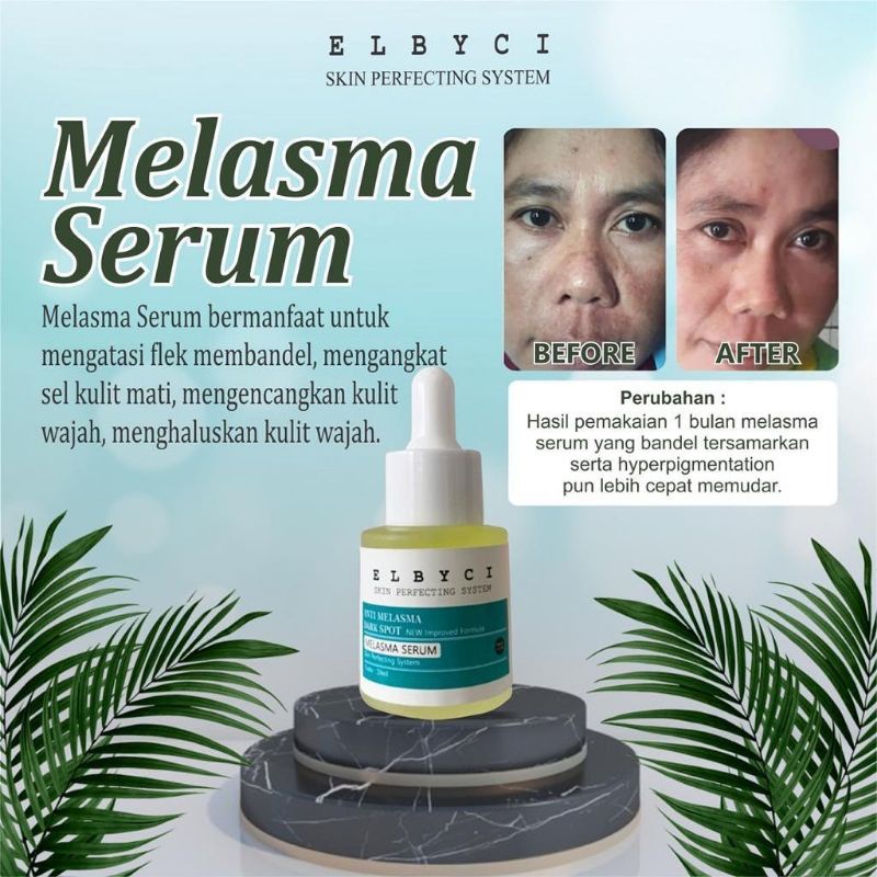 ELBYCI SERUM FLEK MELASMA 20CC NEW PACK AMAN BPOM
