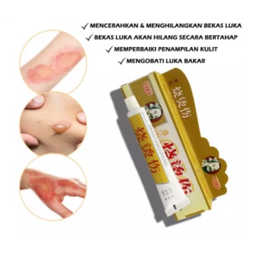 [ BAYAR DITEMPAT ] SALEP CREAM HUATUO SHAO TANG SHANG SALEP HERBAL CINA OBAT LUKA BAKAR PENGHILANG BEKAS LUKA Huatuo Salep Herbal Obat Luka Bakar &amp; Kena Air Panas Minyak Panas Kulit Melepuh Ampuh ORIGINAL ASLI SALEP AMPUH MENGOBATI KULIT MELEPUH