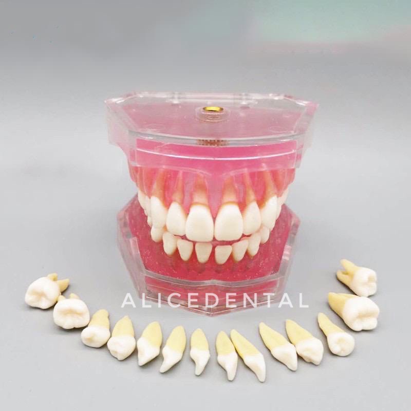 Dental study model typodont gigi bisa dilepas phantom studi edukasi gusi karet soft rubber gingiva