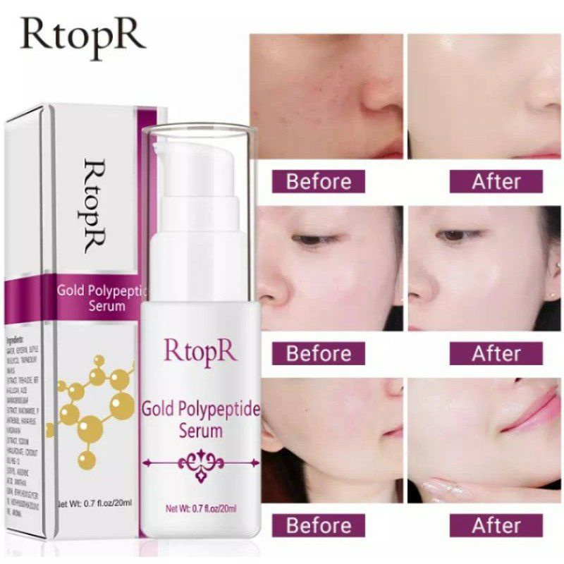 RtopR Gold polypeptide serum#serum anti penuaan dan pemutih Original