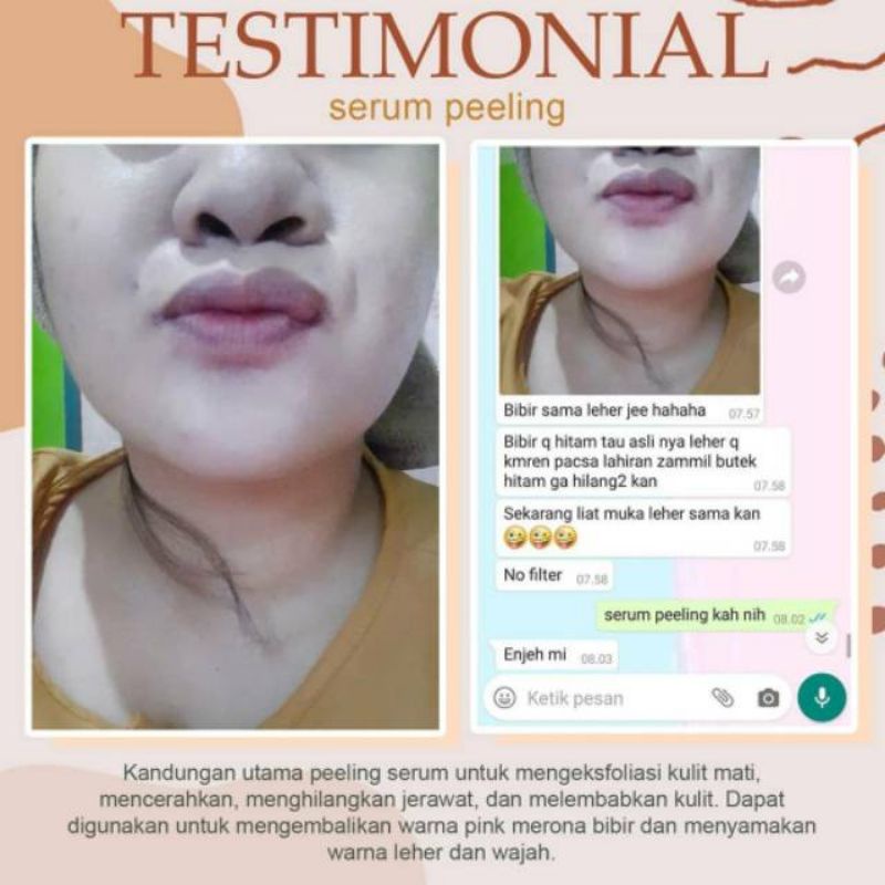 SERUM PEELING ORIGINAL MS GLOW (SUSAH BER BARCODE)