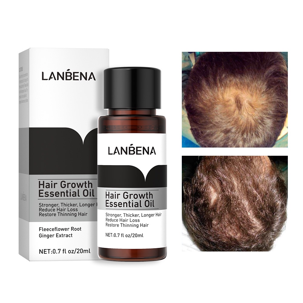 Lanbena Hair Growth Essential Oil 20ml Hair Care Penumbuh Dan Pelebat Rambut 100% Original