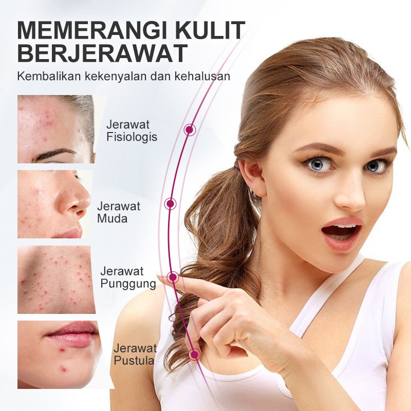 RtopR Mangga Krim Perawatan Jerawat Kontrol Serum Gel Perbaikan Komedo Mengecilkan Pori-pori Bekas luka Pemutih pelembab Perawatan Kulit Kosmetik