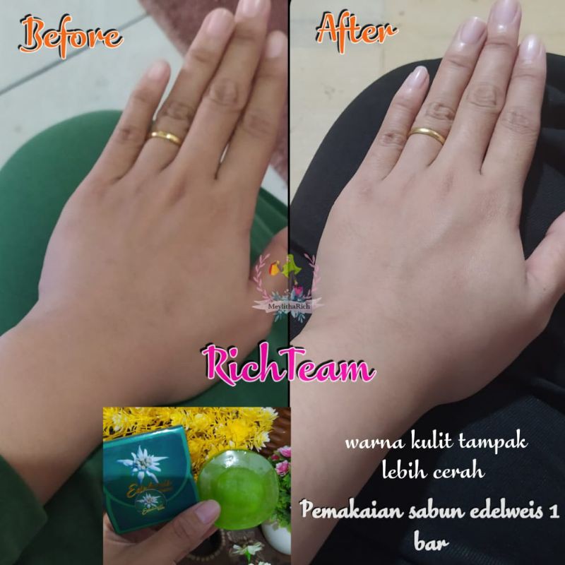 Sabun Bulus Edelweis K-Selaras