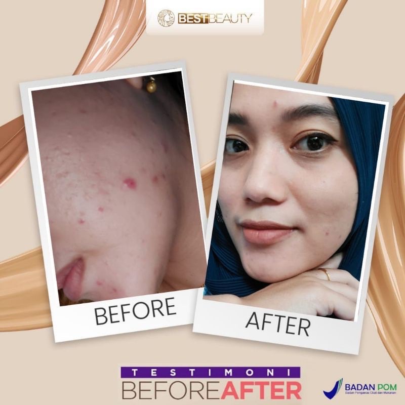 Best Beauty Skincare - Original Bpom-2