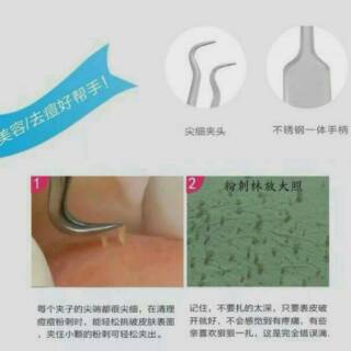 Jual Pinset Komedo Acne Stainless Penjepit Komedo Jepitan Komedo Blackhead Tweezer