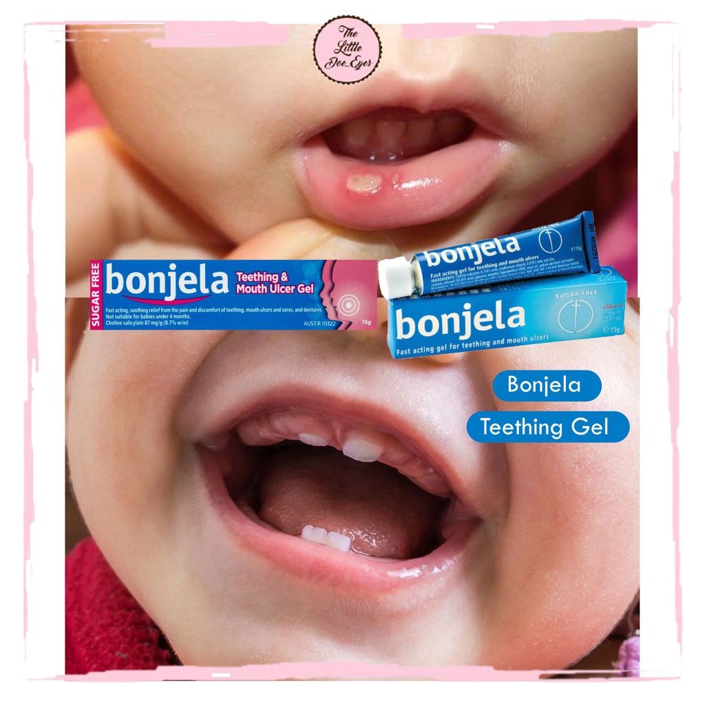 [READY] Bonjela Teething Gel exp 10/2023