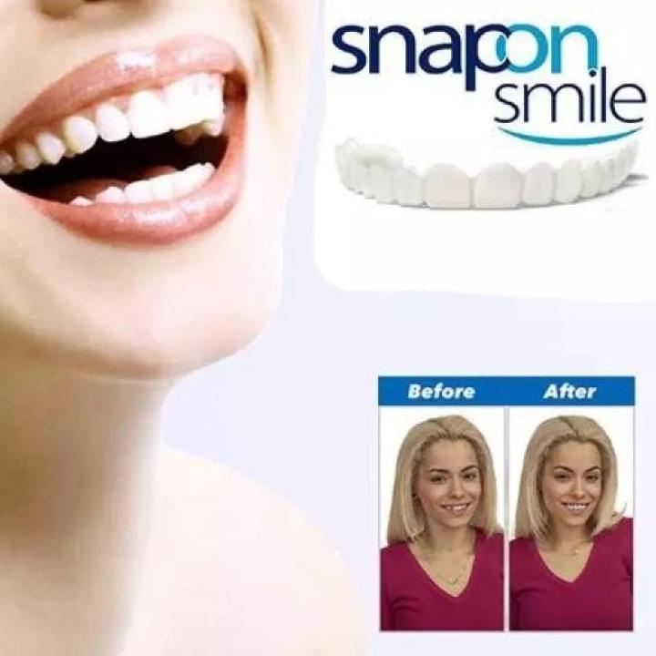Grosir ✧ gigi palsu instan ORIGINAL 100 % snap on smile original 100% gigi palsu instan atas bawah