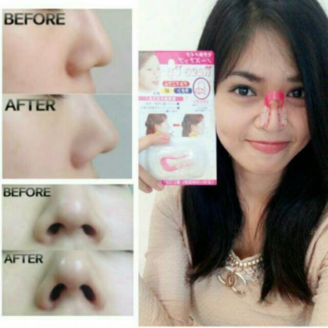 Nose Up Jepang / Alat Clipper Pemancung Hidung Nose Clipper Pink
