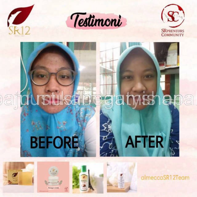 KEFIR ETAWA MASKER BPOM TERBAIK..! KULIT BERMINYAK &amp; SENSITIF / KEFIR MASK SUSU KAMBING ETAWA ASLI
