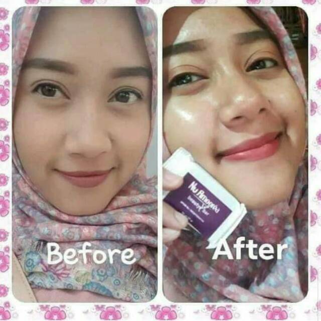 ORIGINAL  AMOOREA STEMCELL PLUS 15GR ORI PT DEP