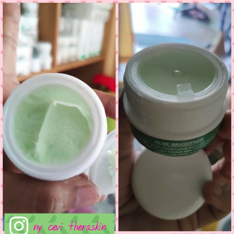 es glow acne night cream