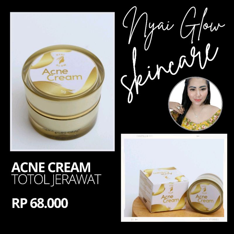 Acne cream nyai glow skincare/obat jerawat produk ori 100%