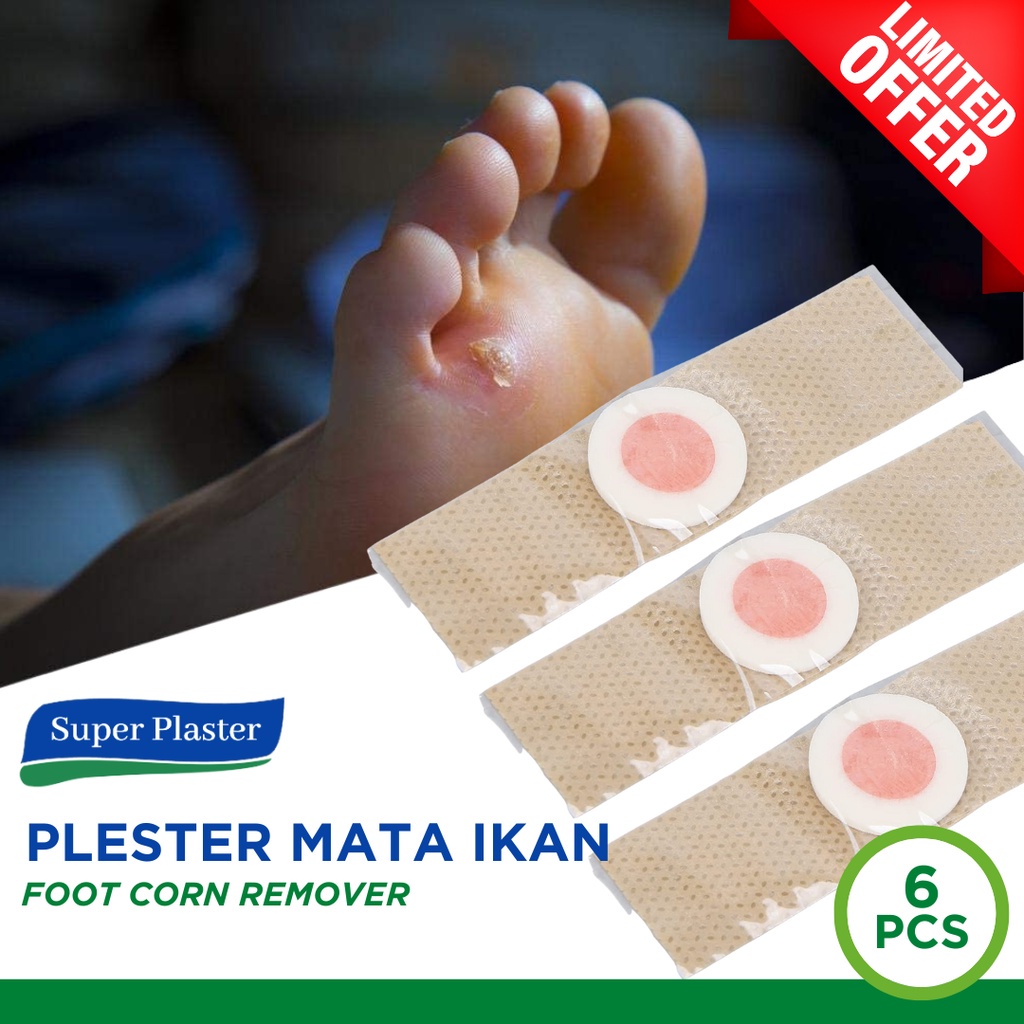 Plaster kutil mata ikan - plester kutil