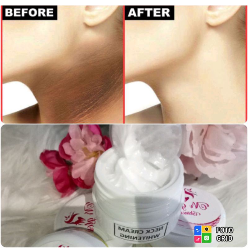 CREAM PEMUTIH LEHER AMPUH/NECK CREAM ANTI WAJAH PUTIH LEHER HITAM