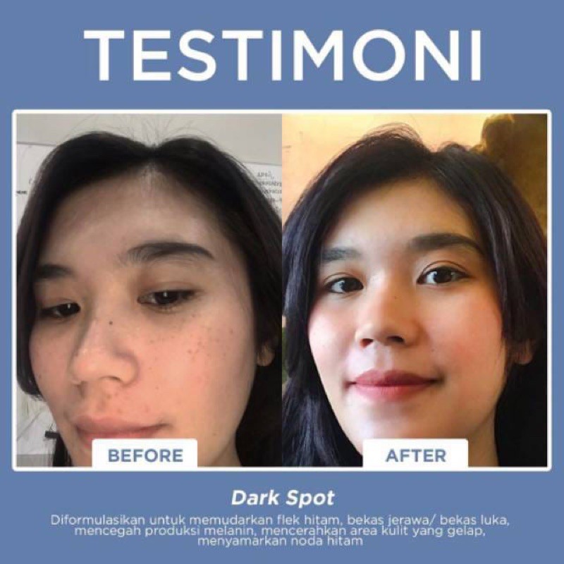 spot treatment solution